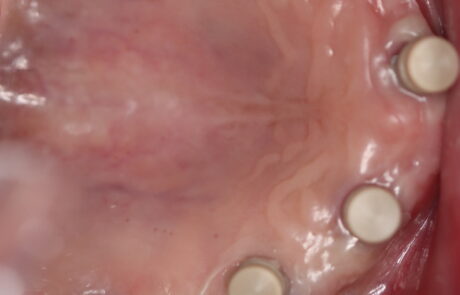 1C9A38CE-E4EE-4950-851A-DBB43839BEB6_1_105_c