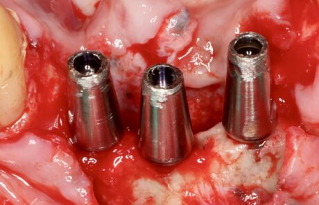 781F7051-86E8-4471-B707-069793125F72_1_201_a