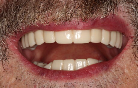 8E4A638A-3409-4C6D-9671-BEC2598CB3D8_1_105_c