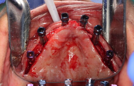 92B62EB0-EA44-4577-9632-F52E63C49A3B_1_105_c