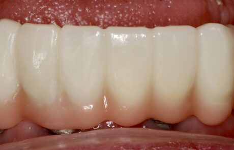 953A0F15-EED5-473A-A802-DC12A2CBE66A_1_105_c