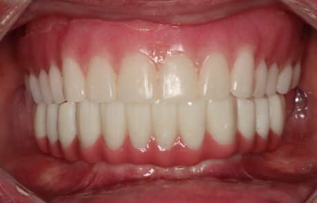 C0448CE3-5138-4340-8392-DECAAE3D0F2A_1_105_c