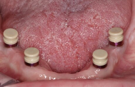 C0FD074B-D385-48A1-958D-AB878A06FB6F_1_105_c