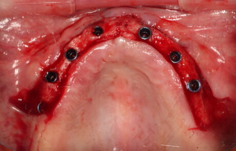 C411EA25-6BE1-4C06-8318-7B7FE87C82E7_1_105_c