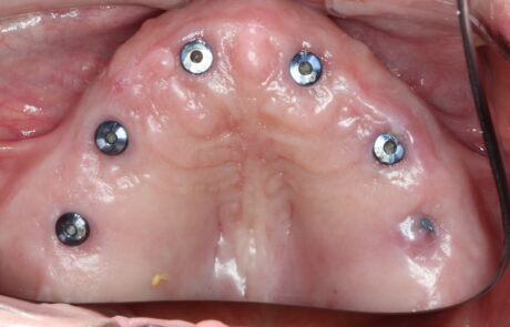 C9DA008F-8B9B-4AC6-8791-365432EDED9A_1_105_c