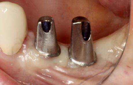 D36C3203-6E89-4B3D-9A15-52B96BF4FAD8_1_201_a