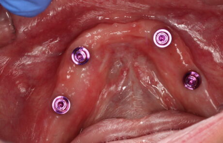 E0F9D3FA-1A6D-4C9B-8E4B-92EB155934FE_1_105_c