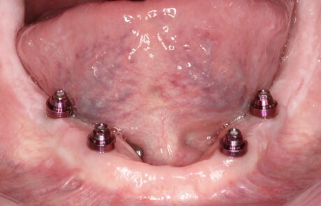 E1DB5C87-B4CC-453C-BACD-FDC521830F0A_1_105_c