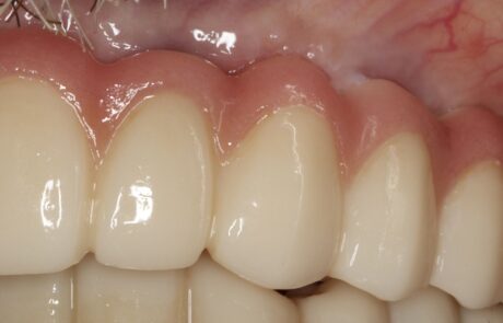 EECC811D-E7A9-436A-86C2-F46B25DC74A6_1_105_c